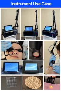 Portable Co2 Franctional Laser For Anti-Aging Skin Rejuvenation