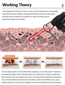 Portable Co2 Franctional Laser For Anti-Aging Skin Rejuvenation