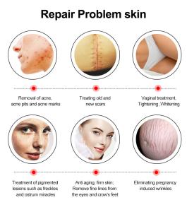 Portable Co2 Franctional Laser For Anti-Aging Skin Rejuvenation