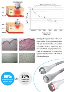 Hot Sale Freezewaves Body Contouring Machine Microwave Technology Fat Loss Skin Tightening