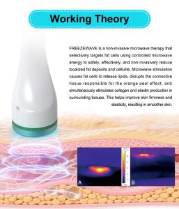 ICE-MICROWAVE RF Body Sculpting Machine Freezewave Skin Tightening Face Lifting Anti-aging Machine