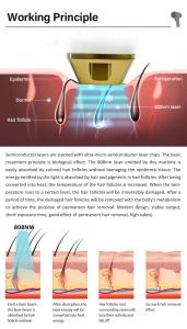 Ice Painless Diode Laser 755 808 1064 Hair Removal Epilation Definitive Laser Hair Removal Machine
