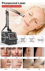 Desktop Picolaser Machine for Tattoo Removal Pigment Removal 532/755/1064nm