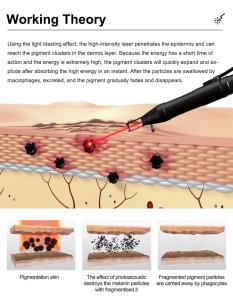 Desktop Picolaser Machine for Tattoo Removal Pigment Removal 532/755/1064nm