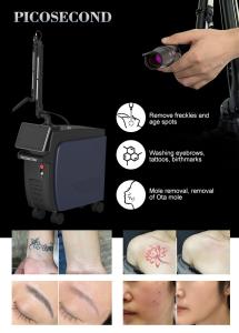 Vertical Picosecond 755nm 808nm 1064nm Picolaser Nd Yag Freckle Tattoo Removal Machine