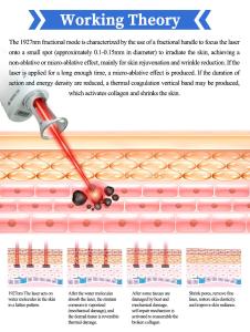 Fractional 1927nm Erbium YAG Laser Machine 12.1inch Touch Screen Stationary for Acne Scars Removal Pigmentation Reduction