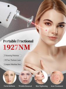 Desktop Thulium Laser Fiber 1927nm Laser Skin Resurfacing Equipment 1927nm Beauty Laser