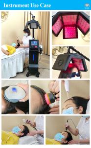 Scalp Treatment Machine Follicle Scalp Detection 650nm Laser Hair Growth/Regrowth Machine Anti-hair Loss Beauty Equipment