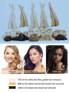 Hair Removal 3 Wavelength 755nm 1064nm 808nm Ice Painless Diode Laser Hair Removal Machine