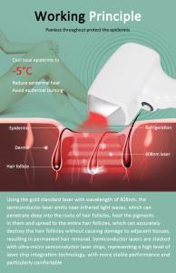 Hair Removal 3 Wavelength 755nm 1064nm 808nm Ice Painless Diode Laser Hair Removal Machine