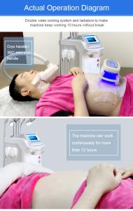Fat Freezing Weight Loss Cellulite Removal Cool Therapy Big Handles 360 Cryo Slimming Machine