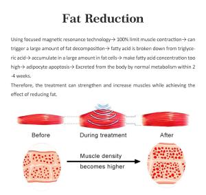 MS-11 High Intensity Electromagnetic Chair Pelvic Floor Muscle Postpartum EMS Vaginal Tightening Beauty Machine