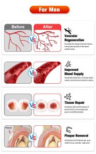 SW319 Shockwave Therapy Machine for Reduce Cellulite Soft Tissue Repair Injury Recovery Spinal Injury Treatment