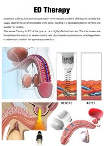 SW319 Shockwave Therapy Machine for Reduce Cellulite Soft Tissue Repair Injury Recovery Spinal Injury Treatment