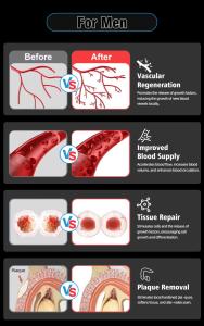 SW267 Newest Shock Wave Therapy Device Physical Therapy Shockwave Machine for Pain Relief