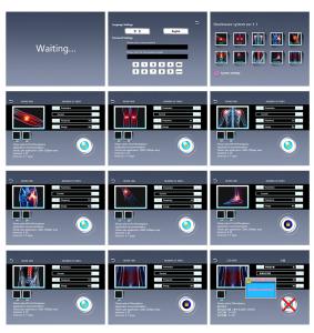 SW267 Newest Shock Wave Therapy Device Physical Therapy Shockwave Machine for Pain Relief