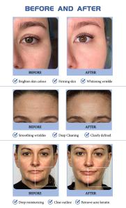 Dermabrasion 16 in 1 Oxygen Jet Hydro Salon Facials Machine Aqua Peeling Beauty Face Equipment Facial Machine Spa909H