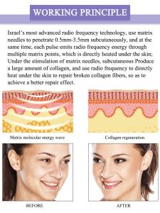 Newest Fractional Vacuum Rf Microneedle Gold Radio Frequency Micro Needle RF Skin Rejuvenation Vacuum Rf Lifting Machine Br816