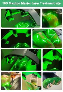 XM-868 10D+EMS Maxlipo Master Laser Green Laser and EMS for Weight Loss Machine