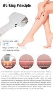 Desktop Hair Removal 808nm Diode Laser Permanent Hair Loss Painless Machine