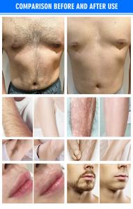 Desktop Hair Removal 808nm Diode Laser Permanent Hair Loss Painless Machine