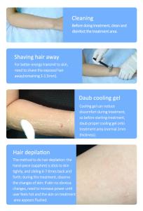Desktop Hair Removal 808nm Diode Laser Permanent Hair Loss Painless Machine