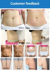 Non-invasive 6D Laser Body Slimming Lipo with Cool Pads 2 in 1 Machine