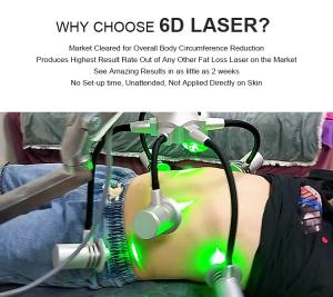 6d Non-invasive Laser 532/635nm Equipment Fat Removal Body Contouring Machine Xm-685