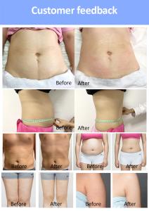 6d Non-invasive Laser 532/635nm Equipment Fat Removal Body Contouring Machine Xm-685