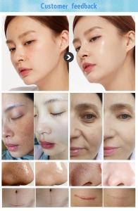 Oxygen Skin Peeling Blackhead Removal Facial Cleanser Spa Use Machine Spa M86