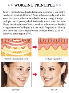 Microneedling Therapy System RF Fractional Microneedle for Wrinkle Removal and Skin Tightening Machine