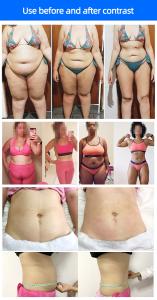 4D 528nm 4 Wavelengths Work Together Diode Lipolaser Body Slimming Machine