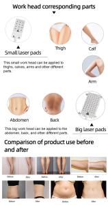 4D 528nm 4 Wavelengths Work Together Diode Lipolaser Body Slimming Machine