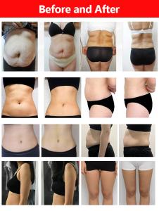 LIPOLASER EMS Laser Pad 4 Wavelengths 635nm 650nm 940nm 980nm Body Slimming Machine