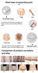LIPOLASER EMS Laser Pad 4 Wavelengths 635nm 650nm 940nm 980nm Body Slimming Machine
