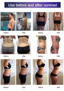 Lipolaser Diode Laser Weight Loss Machine