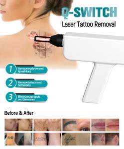2 in1MultifunctionalIPL&Q-Switch Hair Removal and Skin Beauty