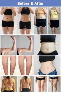3 in 1 SWTLIPO Shockwave and EMS and Pressotherapy for Body  Therapy and Leg Massage Machine