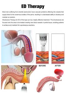 3 in 1 SWTLIPO Shockwave and EMS and Pressotherapy for Body  Therapy and Leg Massage Machine