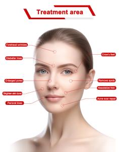2 in 1 1927nm+1550nm Thulium Laser & Erbium Laser Skin Care Skin Rejuvenation  Beauty Machine ThulErbe Dual Pro 68
