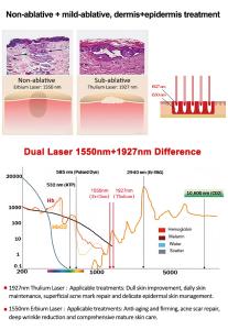 2 in 1 1927nm+1550nm Thulium Laser & Erbium Laser Skin Care Skin Rejuvenation  Beauty Machine ThulErbe Dual Pro 68